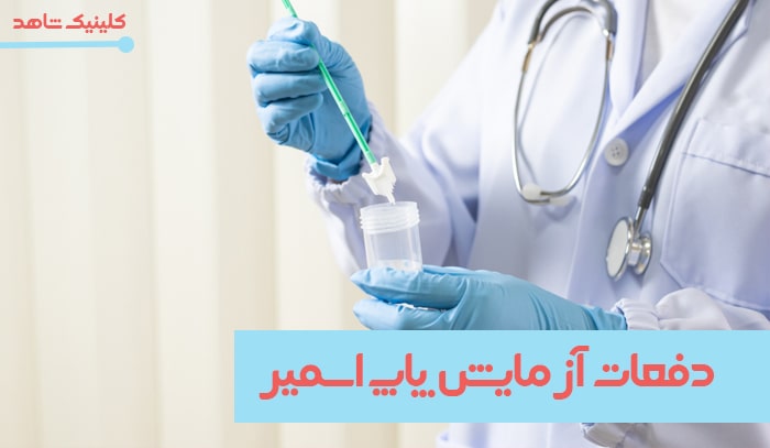 زمان انجام پاپ اسمیر