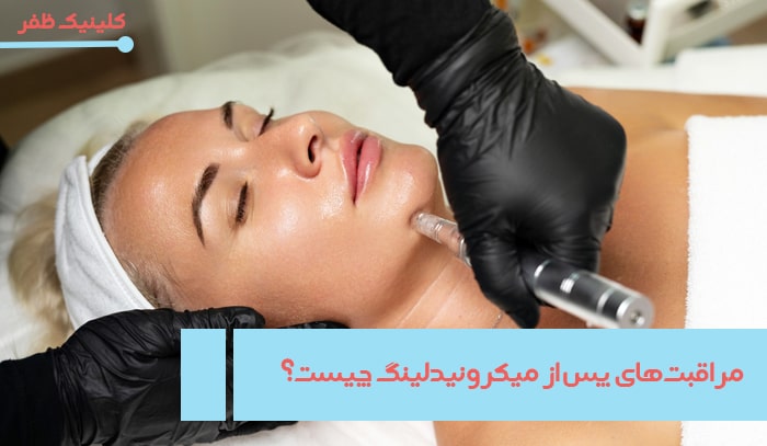 http://مراقبت‌های%20پس%20از%20میکرونیدلینگ