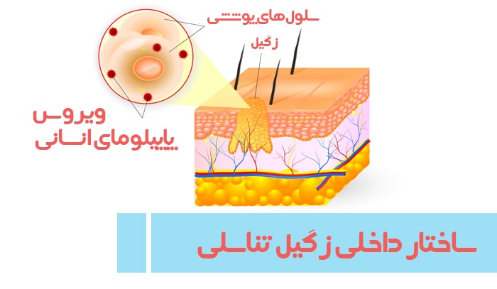 ساختار زگیل تناسلی