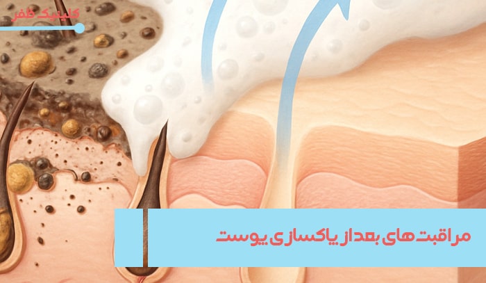 مراقبت‌های پس از پاکسازی پوست