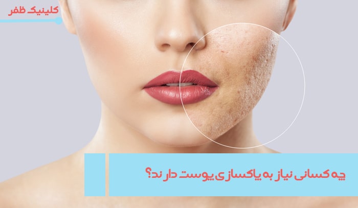 چه کسانی نیاز به پاکسازی پوست دارند