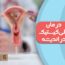 درمان پلی کیستیک در اندیشه