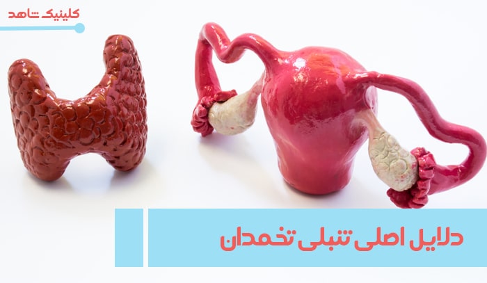 دلایل اصلی تنبلی تخمدان