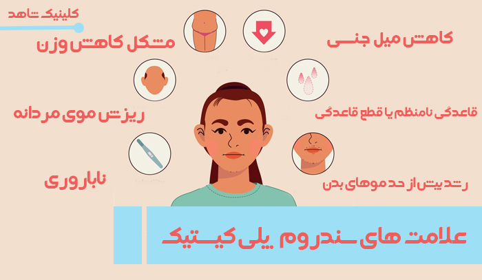 علامت های سندرم پلی کیستیک