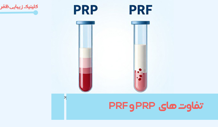 http://تفاوت%20های%20PRP%20و%20PRF