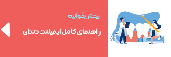 http://ایمپلنت%20در%20اندیشه