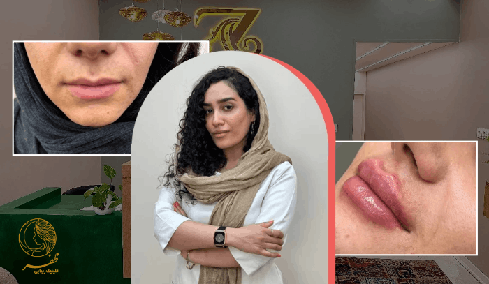 http://تزریق%20فیلر%20لب%20در%20کلینیک%20زیبایی%20ظفر%20اندیشه