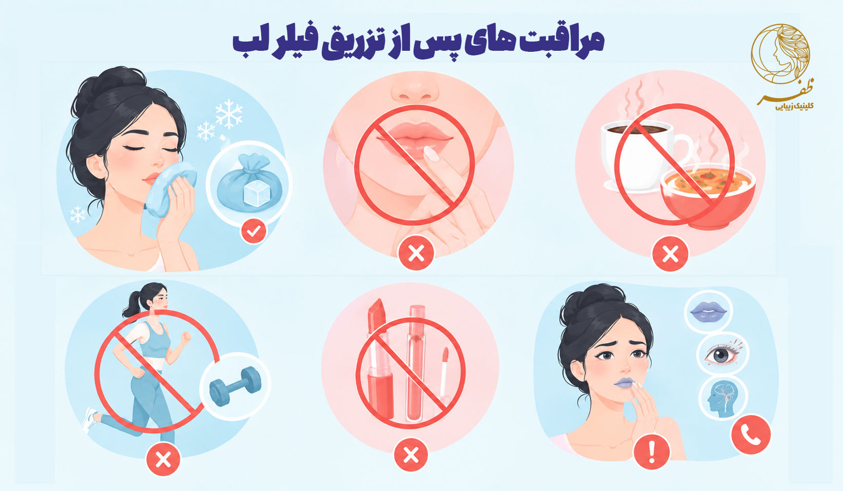 http://باید%20و%20نباید%20های%20پس%20از%20تزریق%20فیلر%20لب